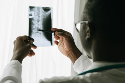 Densité osseuse de la colonne et déclin cognitif : ce que montre une étude de Johns Hopkins
