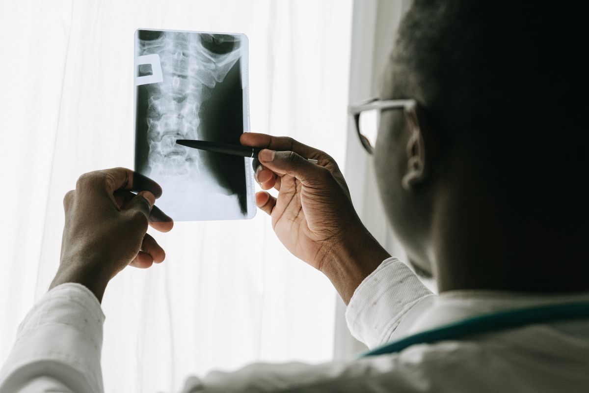 Densité osseuse de la colonne et déclin cognitif : ce que montre une étude de Johns Hopkins
